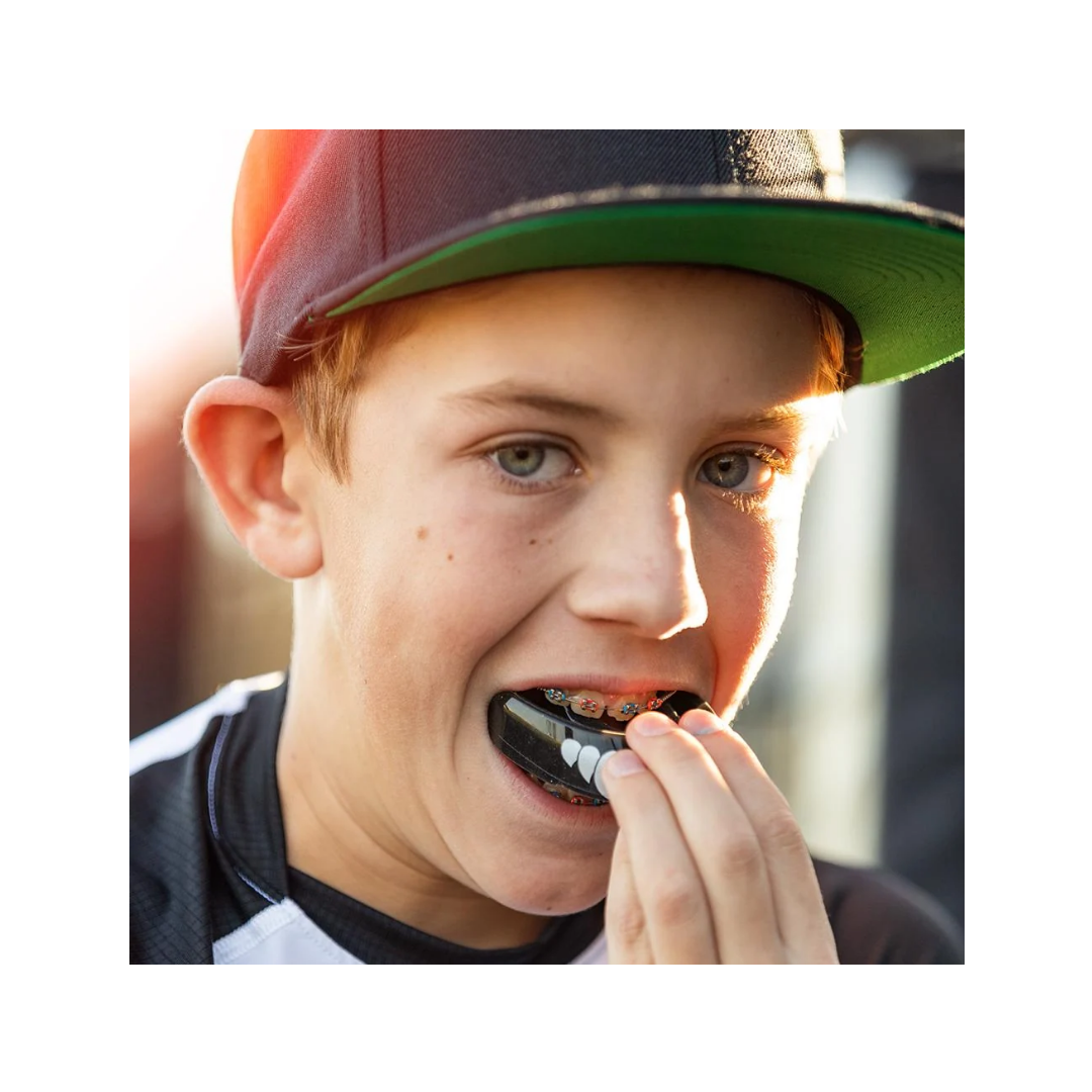 Shock Doctor Fang Double Braces Mouthguard